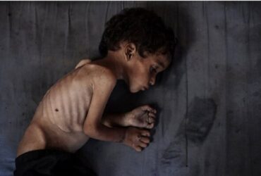 قتل عام در غزه با گرسنگی!